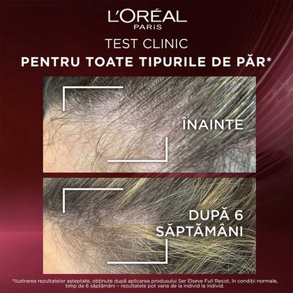 serum elseve full resist cu aminexil toate tipurile de par