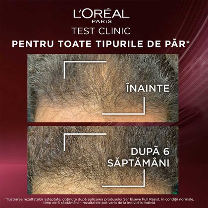 serum elseve full resist cu aminexil toate tipurile de par 2