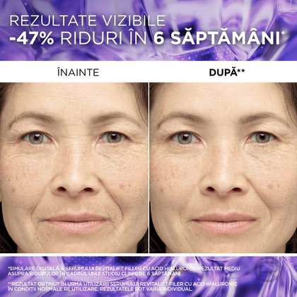 acid hialuronic serum