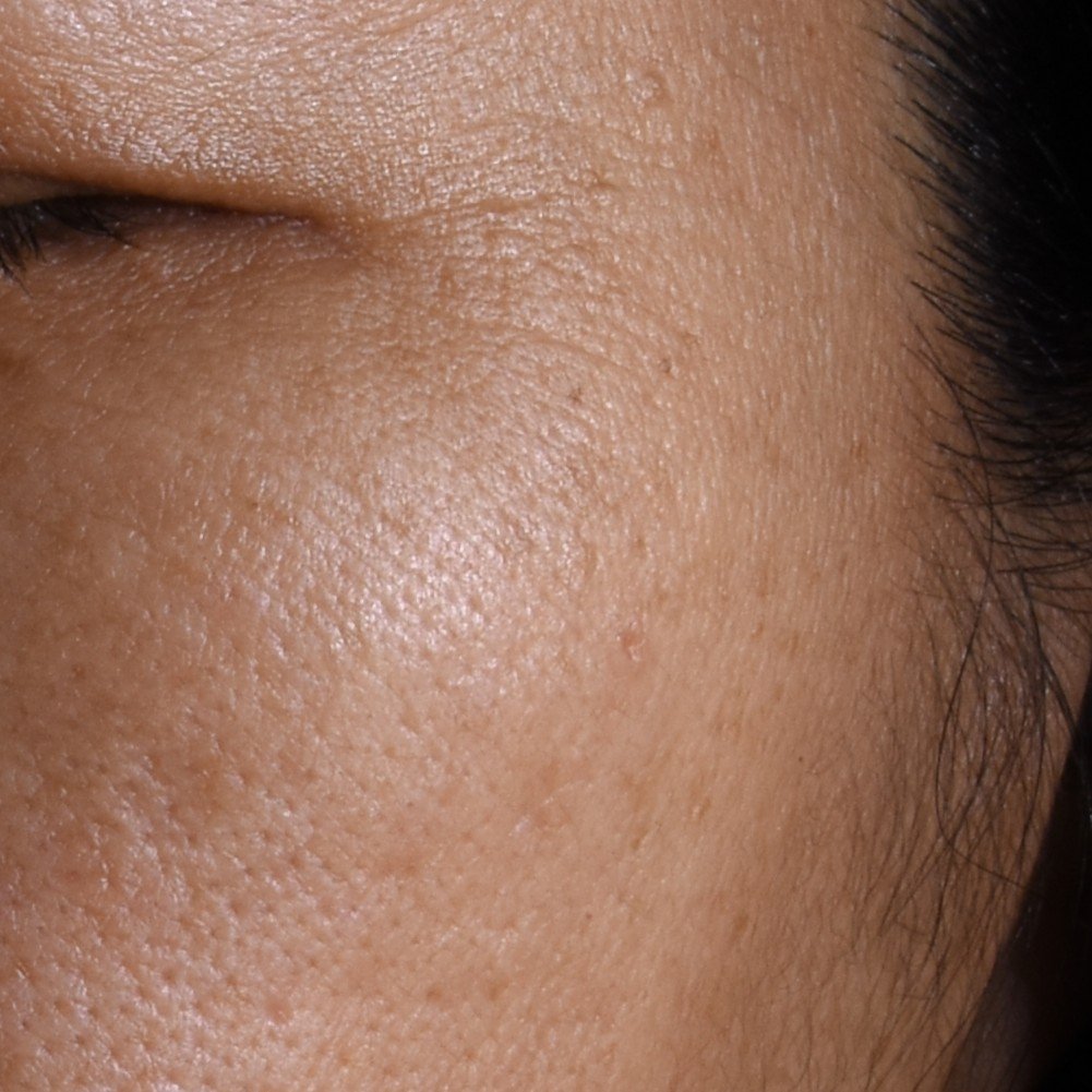 20251124 Oap Age Perfect Melasyl Creamy Serum After Dmi Website Img 1000x1000