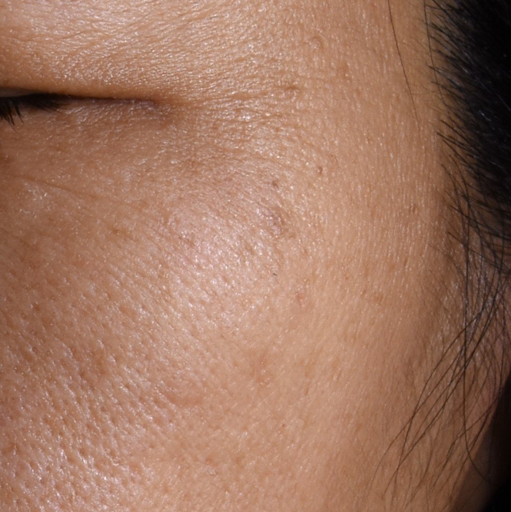 20251124 Oap Age Perfect Melasyl Creamy Serum Before Dmi Website Img 1000x1000