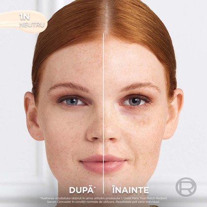 30188181 6